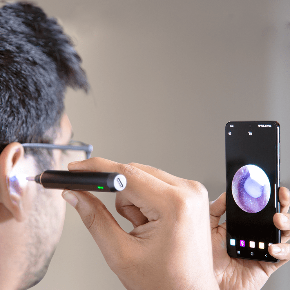Otoscope - Intelligent Ear Wax Cleaner with Smart App
